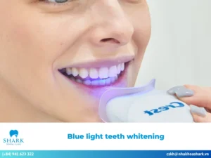 What is blue light teeth whitening? Is it really effective?