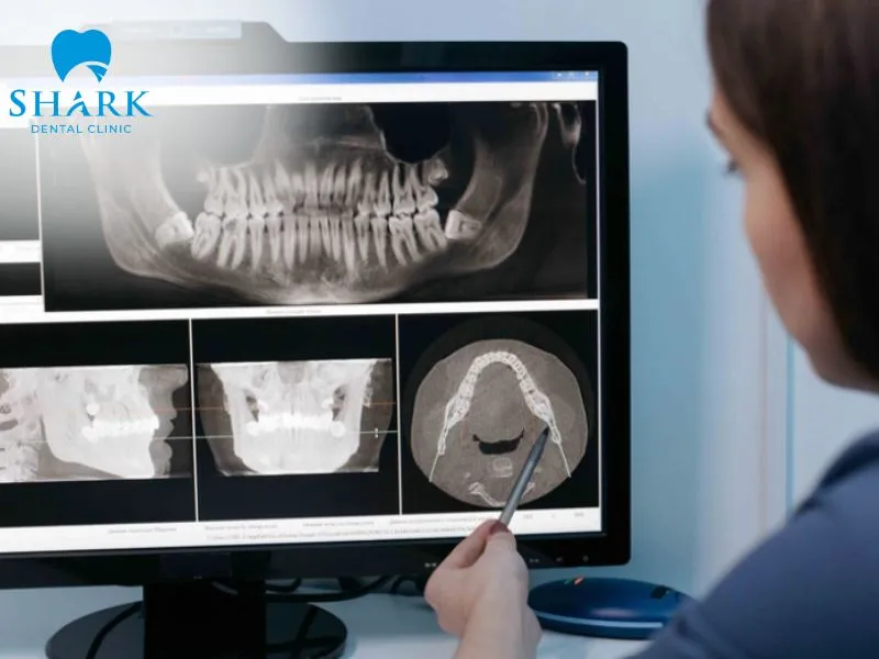 A wisdom teeth xray is considered a safe diagnostic procedure and generally does not have adverse effects on a patient's health