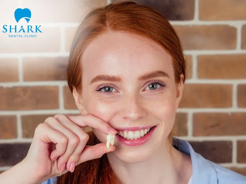 The formation of a wisdom tooth hole may be influenced by several factors, including the extraction technique used and the position or structure of the wisdom tooth itself