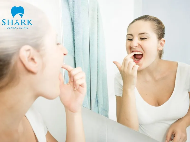 After a tooth extraction, it is completely normal for food particles to occasionally become trapped inside the wisdom tooth hole