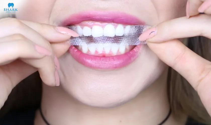 The length of time you should use whitening strips depends on the condition and current shade of your teeth