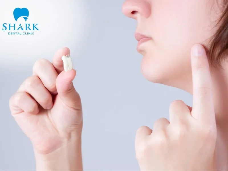 The recovery period after a broken tooth extraction typically ranges from 7 to 14 days