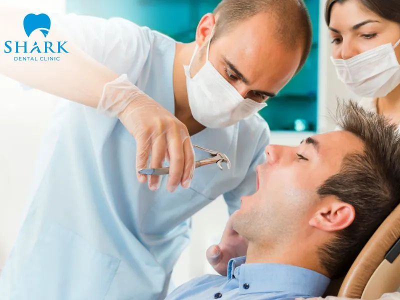 Root canal treatment is also considered an effective solution for managing a wisdom tooth decay in appropriate cases, helping preserve the natural tooth structure