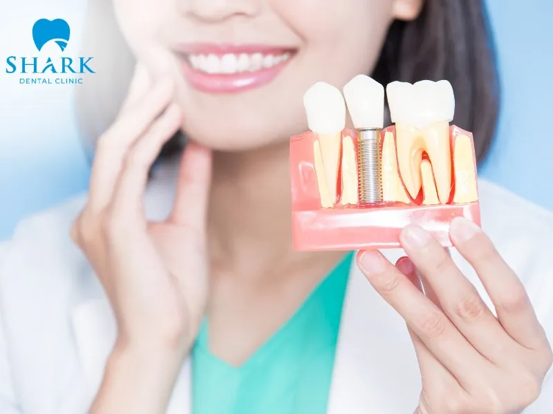 Many patients require bone grafting after tooth extraction to create favorable conditions for future dental Implant placement