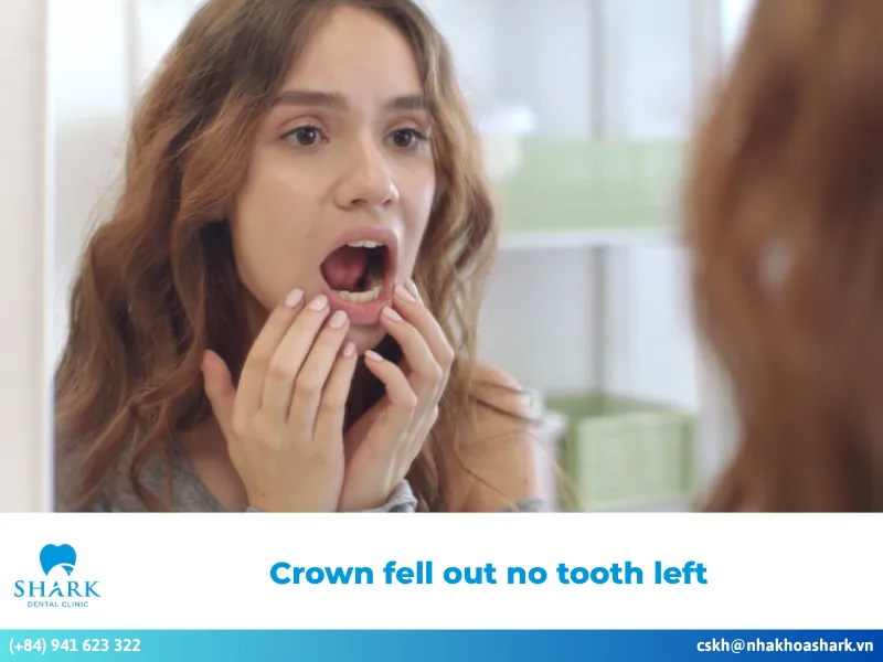 Crown fell out no tooth left underneath? Here is what to do