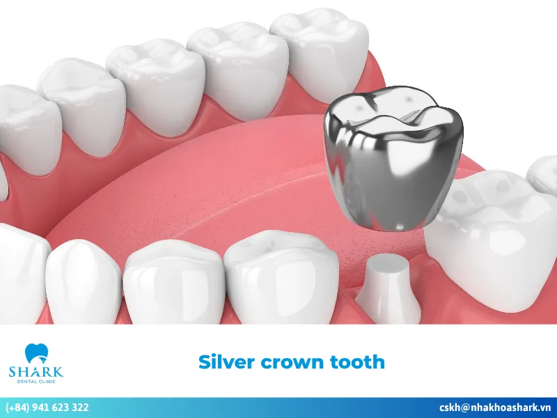 What is a silver crown tooth? Should it be done or not?