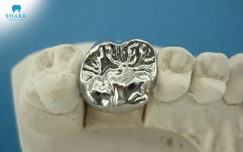 This type of dental crown offers excellent chewing strength and is highly resistant to cracking or fracturing during daily use, making it particularly suitable for restoring molars