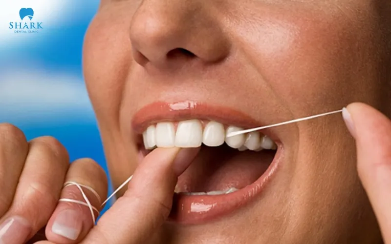 It is recommended to use dental floss or a water flosser as part of your daily oral hygiene routine to help effectively remove plaque and food debris remaining on the teeth