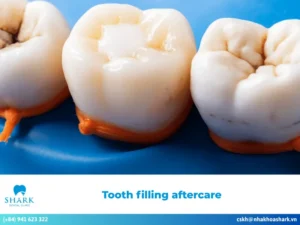 Top 5 effective and easy tooth filling aftercare tips for everyone