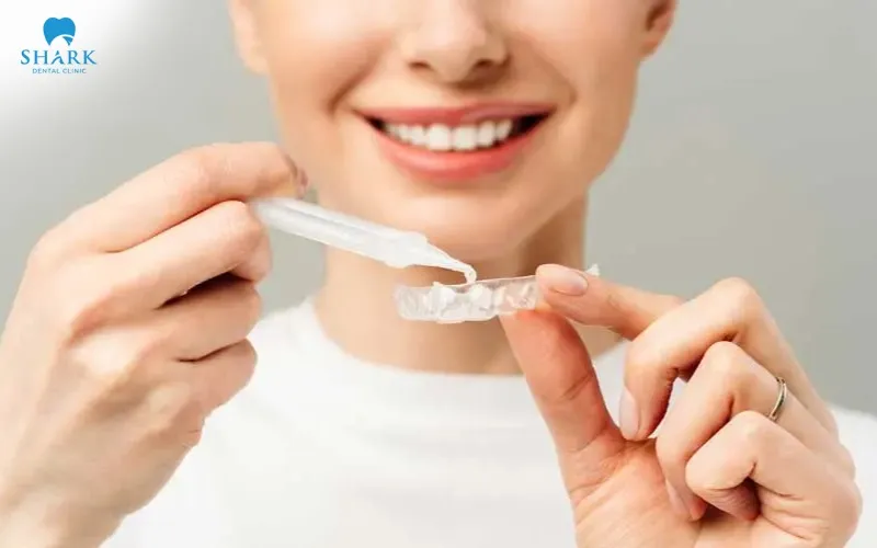 The amount of whitening gel used for each treatment should be controlled carefully and only applied in an amount that is enough to evenly cover the tooth surfaces when the whitening tray is worn