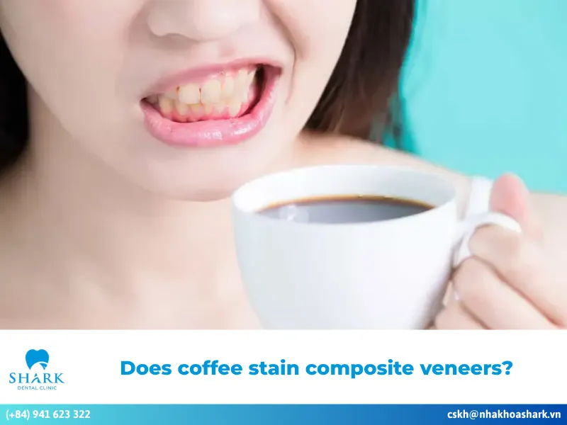 Does coffee stain composite veneers? Care and prevention tips