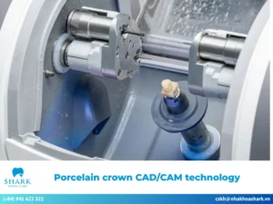 Porcelain crown CAD/CAM technology: Process and benefits