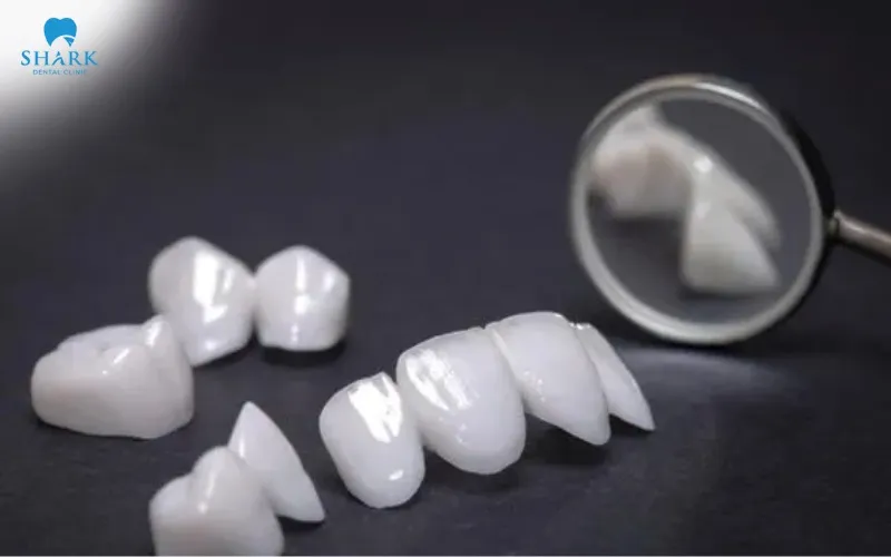 When composite surfaces become worn, rough, chipped, or degraded, replacement may be necessary to restore the appearance and function of the teeth
