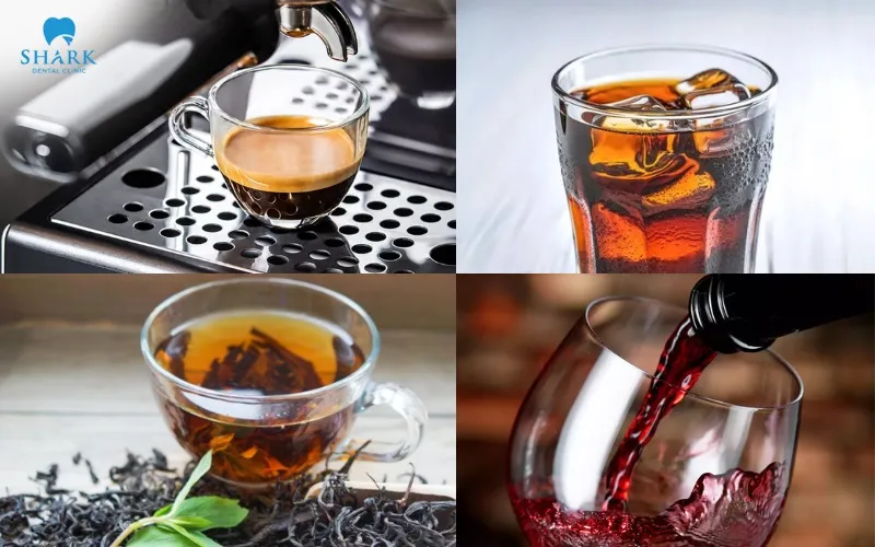 Dark-colored soft drinks, black tea, red wine, and similar beverages may gradually cause teeth and composite restorations to become discolored over time