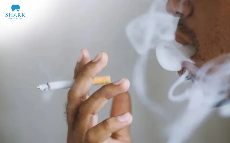 Smokers have a higher risk of dental implant failure than nonsmokers