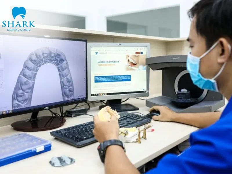 Digital 3D scanning and computer-aided design are two important steps in the process of manufacturing porcelain crowns with CAD/CAM technology