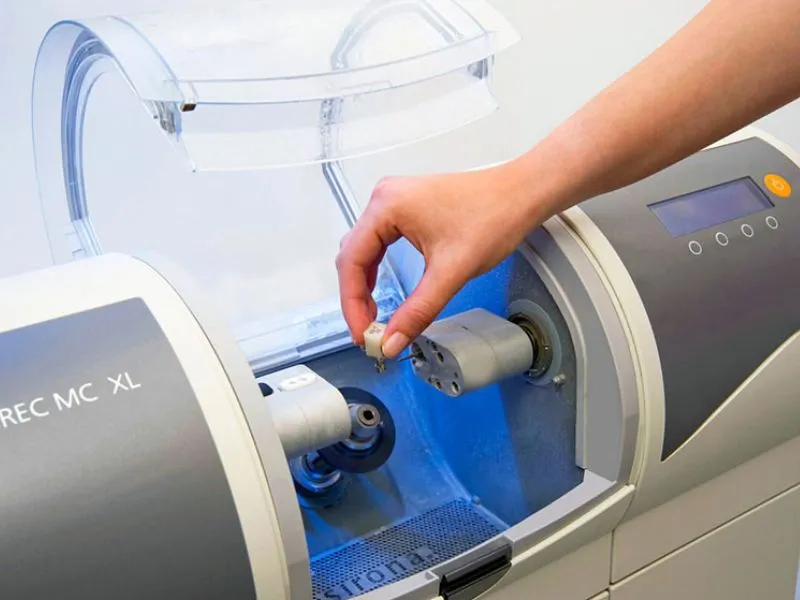 The application of CAD/CAM technology in the design and fabrication of porcelain dental restorations