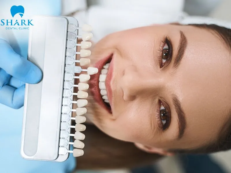 The durability of porcelain veneers depends on the selected ceramic material, the dentist’s technique, and the patient’s daily oral care routine