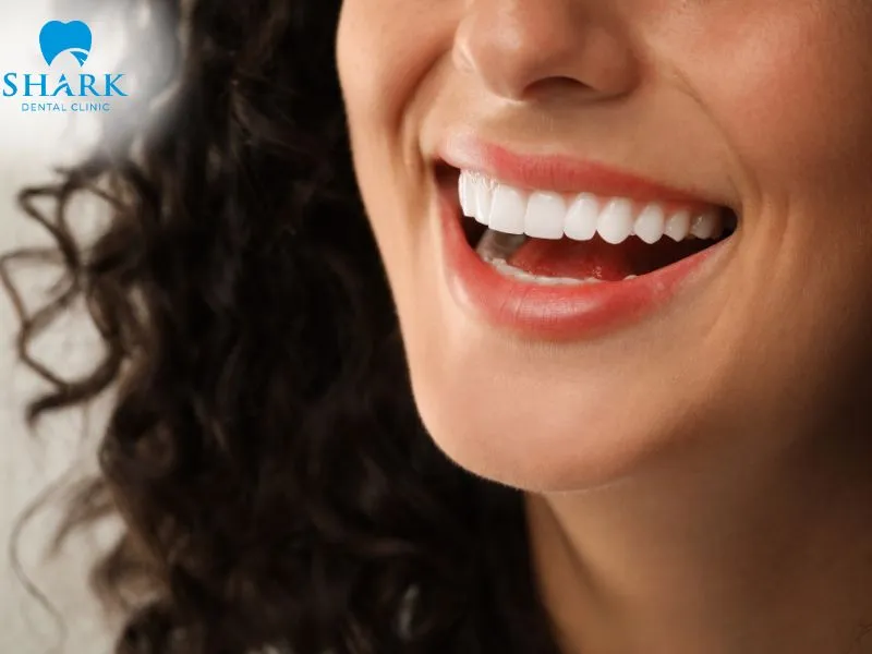 Porcelain veneers offer notable advantages in aesthetic quality and long-term durability, while composite bonding provides a greater advantage in affordability