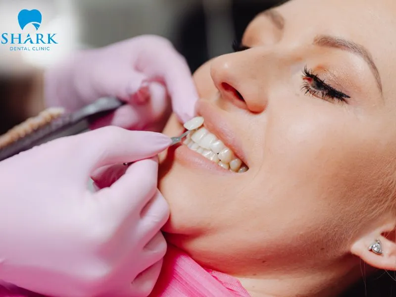 Porcelain veneers involve a high treatment cost and are only suitable for patients whose dental conditions meet the appropriate clinical indications