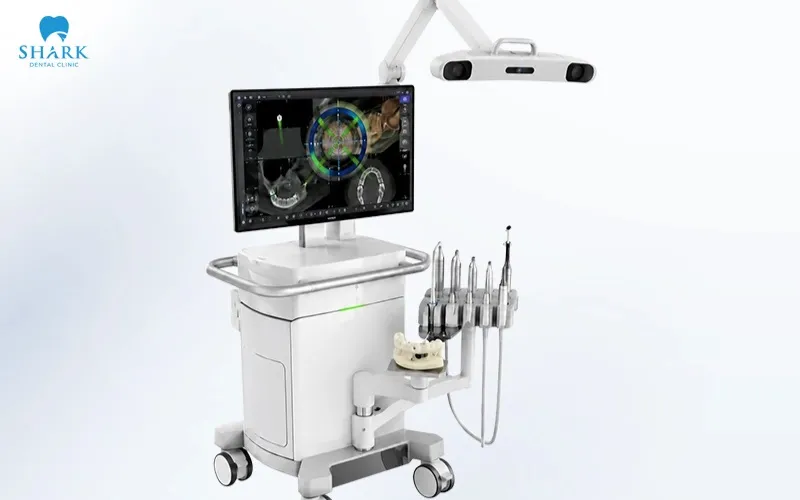 An implant navigation system can generally be thought of as a guidance system that helps provide support to the dentist throughout the entire implant placement procedure