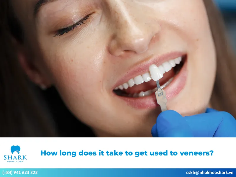 How long does it take to get used to veneers? Quick tips