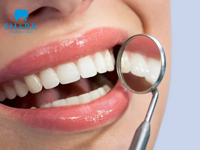 Porcelain veneers can improve the overall appearance of your smile in a natural and aesthetically pleasing way