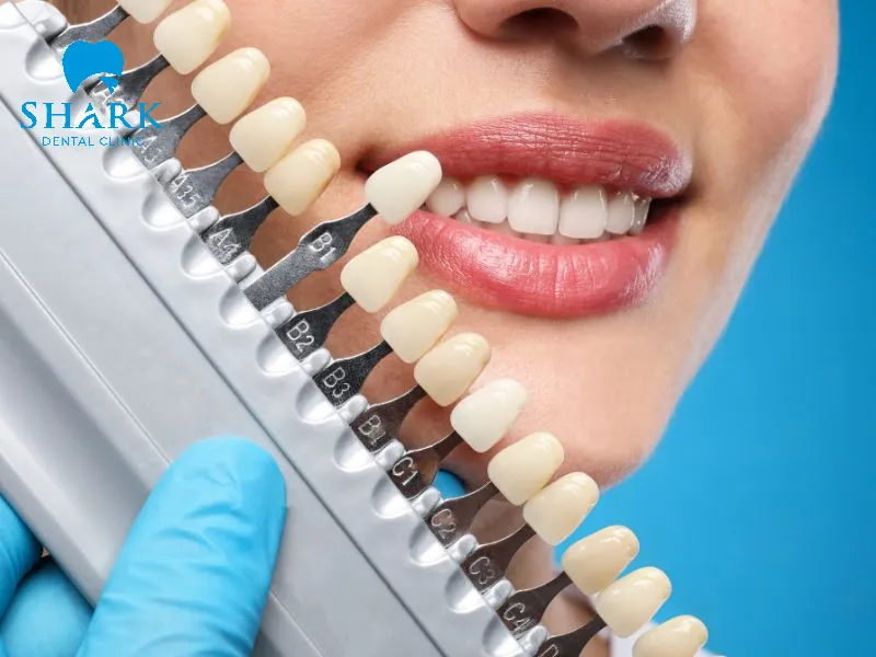 Attend regular dental checkups every 3 to 6 months to evaluate the condition of your teeth and porcelain veneers