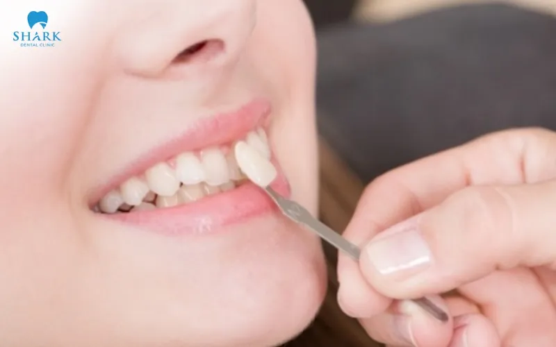 Before crown removal, the dentist examines the restoration, evaluates the prepared tooth and gum tissues, and identifies why the crown must be removed