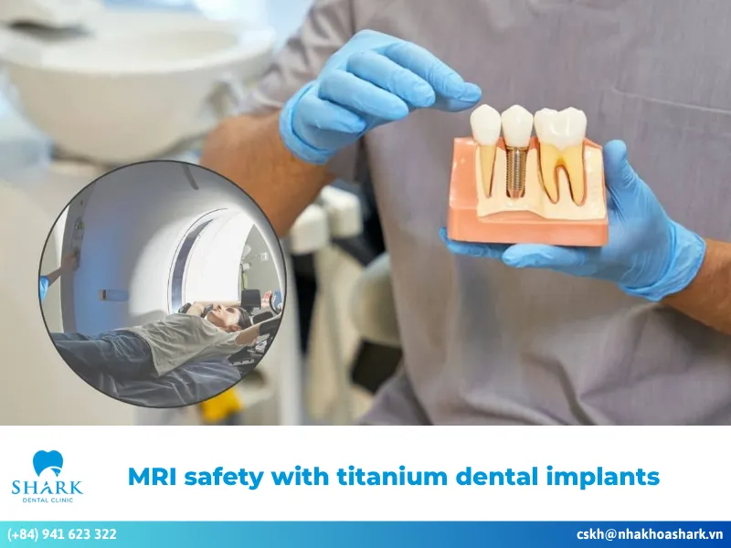 MRI safety with titanium dental implants: Is it really safe?