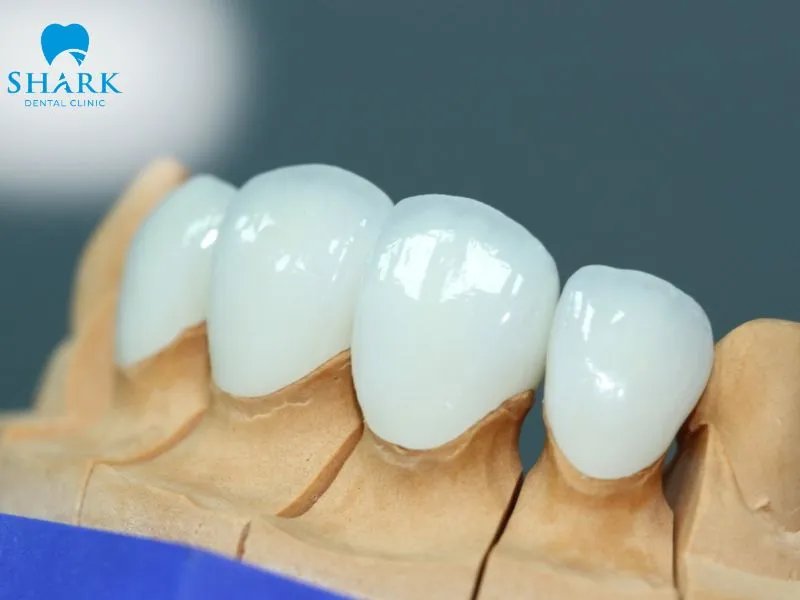 The most effective solution is to replace the existing crown with a metal-free dental crown