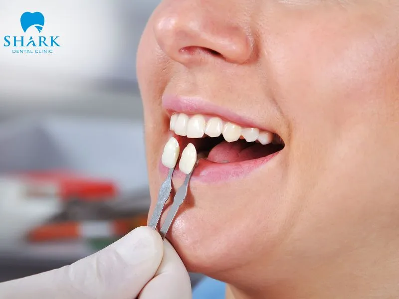 Porcelain crowns help restore the shape, color, and function of teeth in cases involving severe dental damage