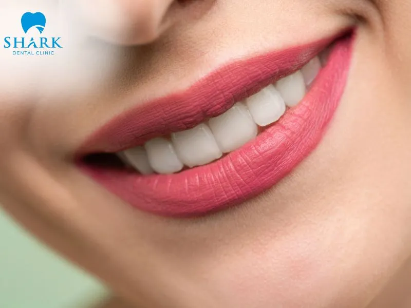 Aesthetic restoration results after completing the required dental treatment