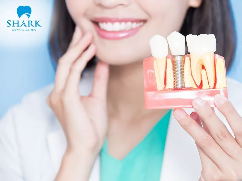 From the third month through to the sixth month, the implant post will fully integrate with the jawbone