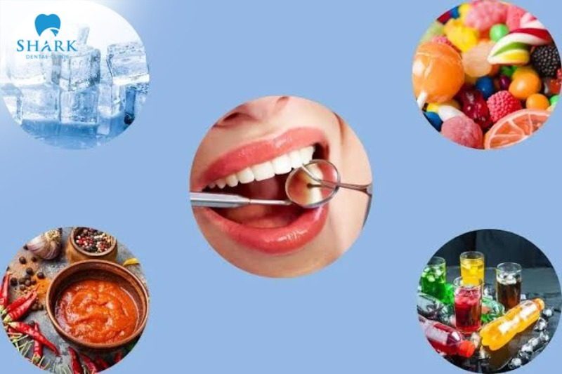 After getting porcelain veneers, avoid strongly colored foods and beverages that may affect their appearance