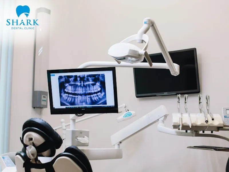 Drill-free fillings are only indicated for certain specific cases and require the use of modern technology
