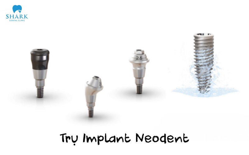 Neodent implants deliver restoration results that are both stable and durable