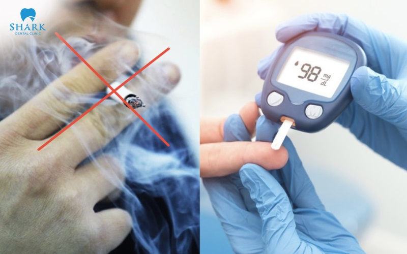 Smokers and diabetic patients are among the groups of patients who require careful clinical assessment before undergoing implant treatment.
