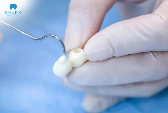 A glass ionomer cement filling is generally considered to be a safe restorative dental technique, and it's often used to improve teeth that have a number of different imperfections