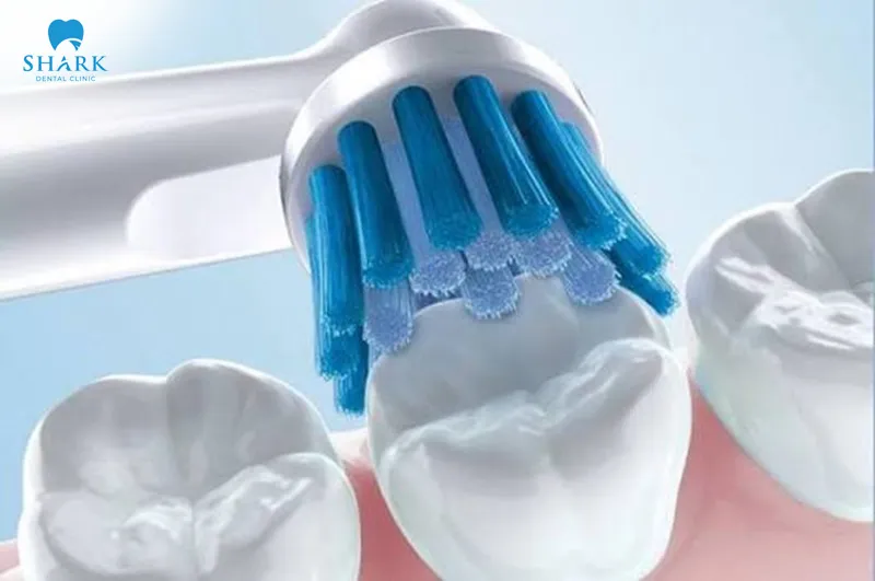 Pay close attention to care and oral hygiene in order to keep negative effects to a minimum