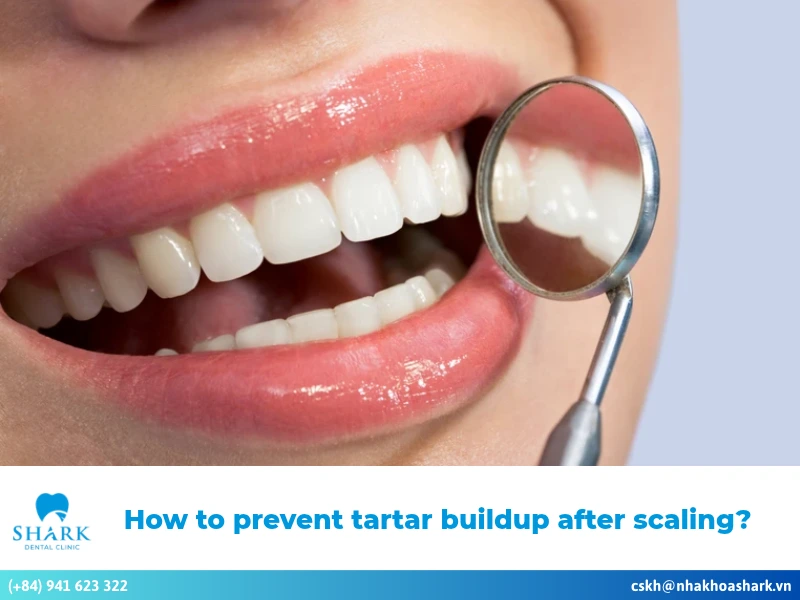Ultimate guide on how to prevent tartar buildup after scaling