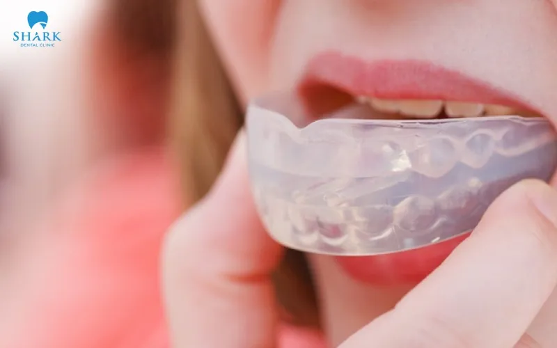 Moldable trays are a type of tray that can be shaped by the user themselves in order to achieve a better fit with their teeth before the tray is used