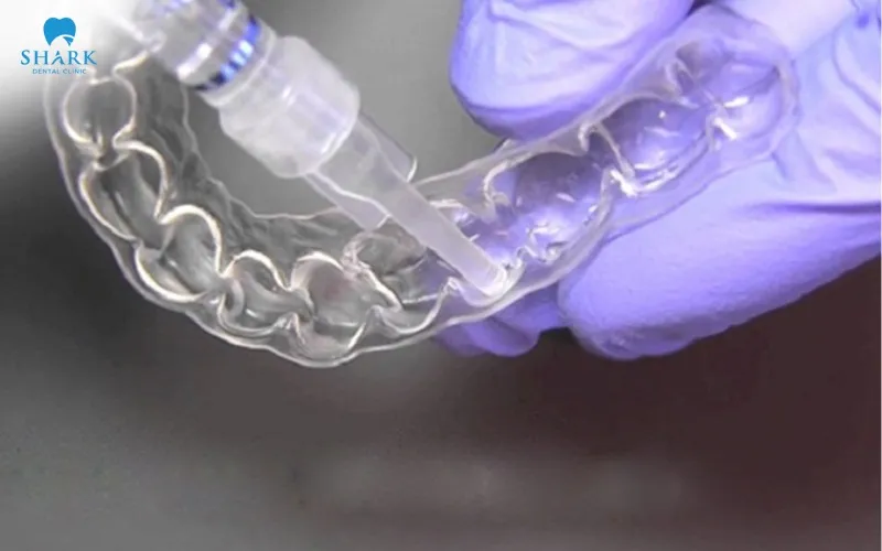 You should place just enough gel into each individual tooth compartment on the tray, while avoiding placing too much, which could cause it to leak out and irritate the gums