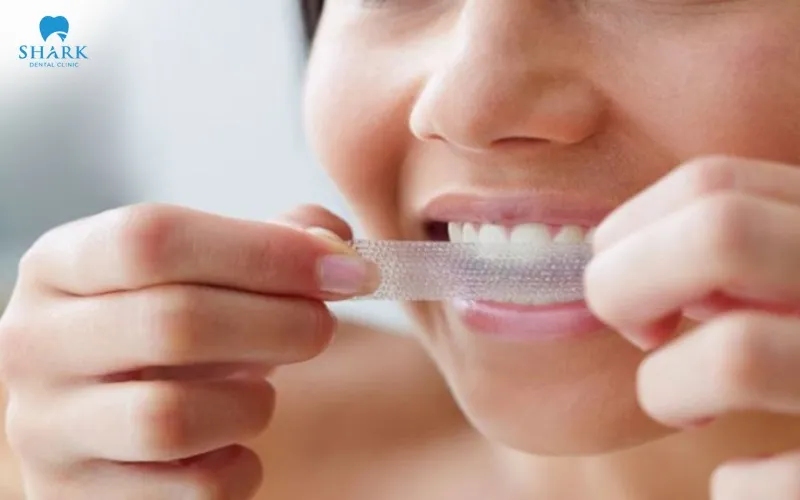 Whitening strips may be used according to the product instructions after confirming that your teeth and gums are suitable for whitening.