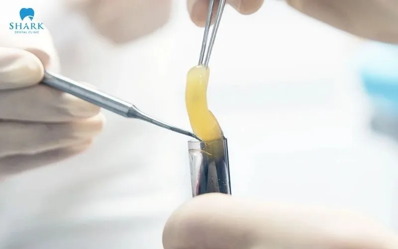 Guided tissue regeneration is a technique that uses a specialised type of membrane to stop fast-growing tissue from moving into the area that needs to be regenerated