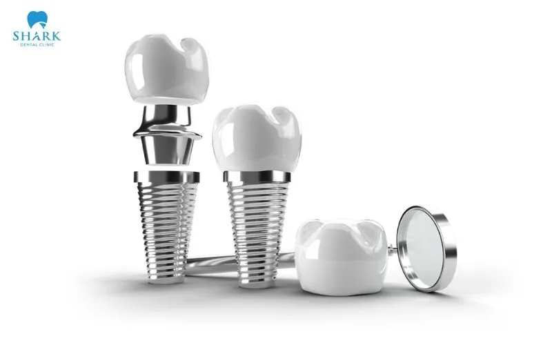 Implant placement is one of the restorative solutions that is considered when bone loss has come about as a result of tooth loss