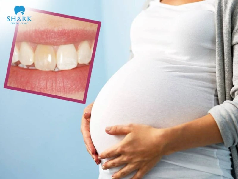 Teeth scaling helps minimize infection and supports proper ongoing oral care and hygiene