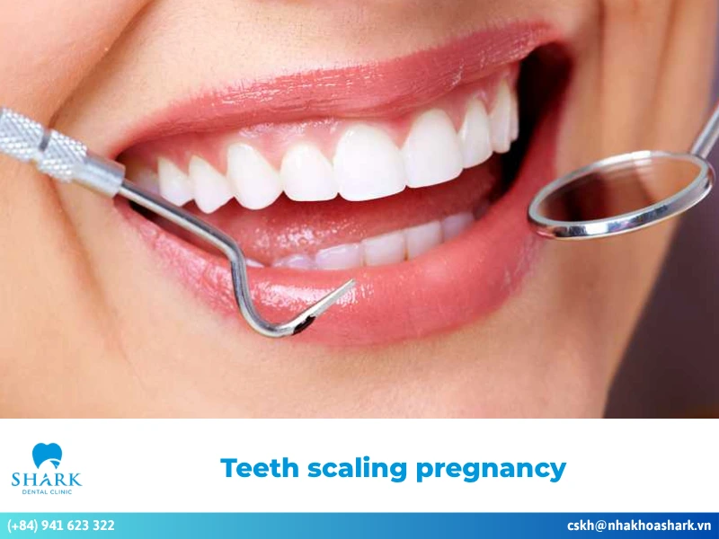 Is teeth scaling pregnancy safe, and does it affect your baby?