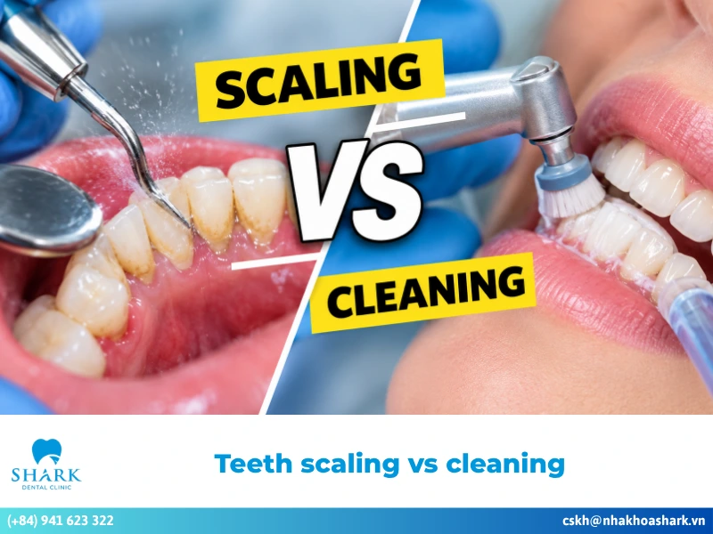 Teeth scaling vs cleaning: How exactly do they differ?