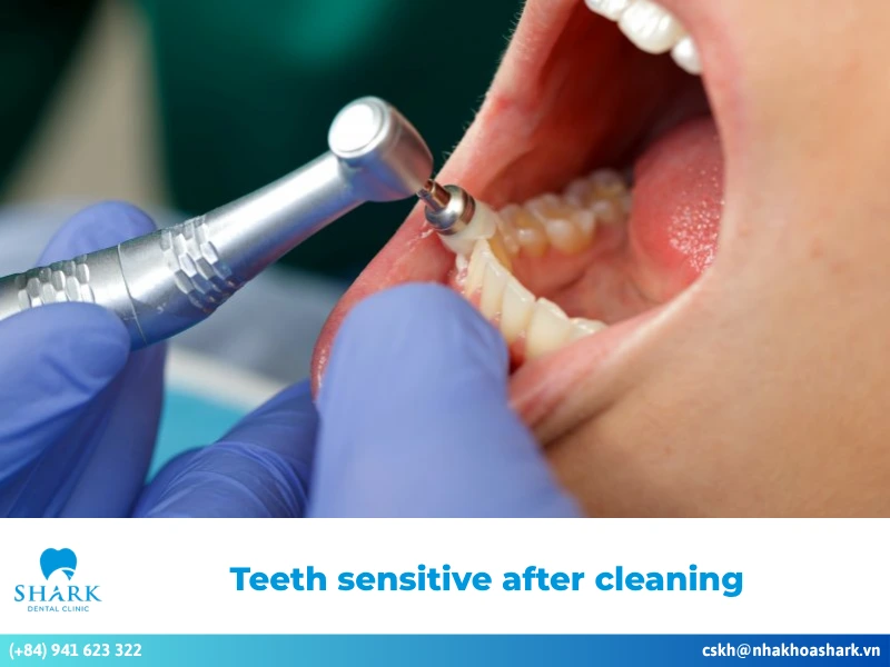 Teeth sensitive after cleaning? Effective ways to address this